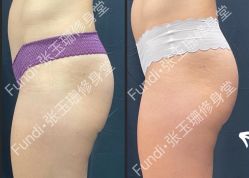 -Fundi张玉珊修身堂·indiba·BTL科技瘦身