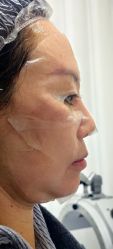 -长沙雅美医疗美容医院