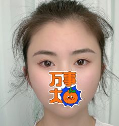 -久匠半永久纹眉