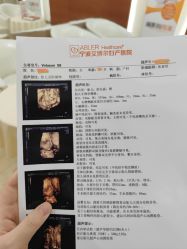 -艾博尔医院