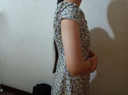 -成都西区医院整形美容