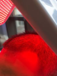 -碧莲盛·不剃发植发