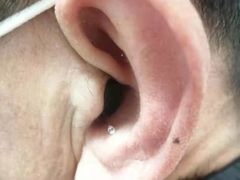 -安湃声助听器(密云店)