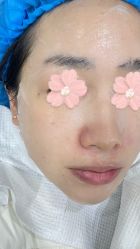 体验后-重庆联合丽格美容医院