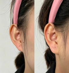 -天津健丽·去眼袋医疗美容机构