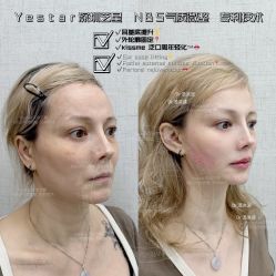 -深圳艺星医疗美容医院