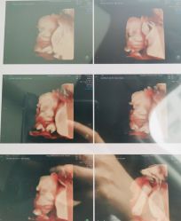 -杭州贝瑞斯美华妇儿医院·早孕·产检·儿科