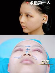 -深圳艺星医疗美容医院