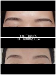 点击看大图 -宥莉·ULLY 痘敏肌•科技皮肤管理中心