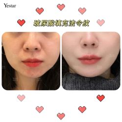 -Yestar艺星医疗美容医院