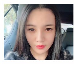 -大麦微针植发全国连锁