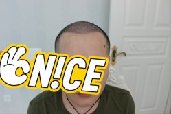 -大麦微针植发丨全国连锁