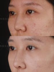 -北京米扬丽格医疗美容·联合丽格鼻整形中心