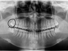 -浙江大学医学院附属口腔医院湖滨（延安）院区
