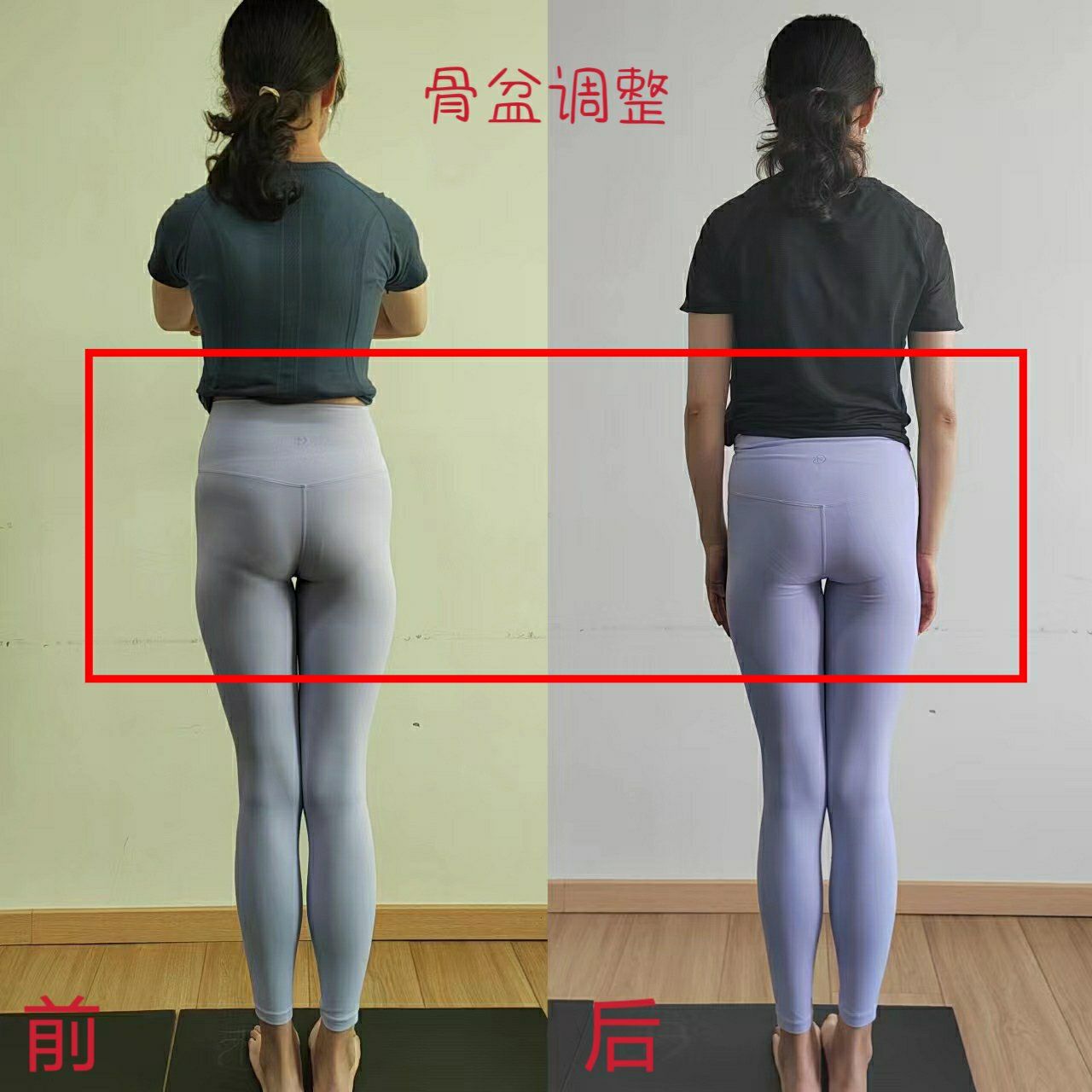 产后骨盆修复对比图