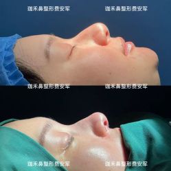 -JustHer宁波珈禾医疗美容医院