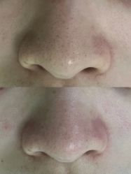 -金品苗方专业祛痘中心