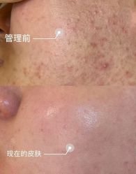 -春田皮肤管理中心品牌旗舰店