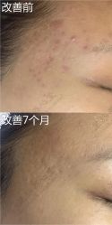 -皇族养心堂·净痘·修敏·御颜