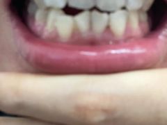 -微笑牙科口腔(三亚迎宾院区)
