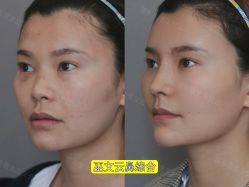 -北京米扬丽格医疗美容·联合丽格鼻整形中心