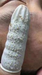 -瑶芳清颜草本祛痘