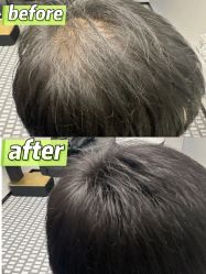 -唐风采假发补发定制