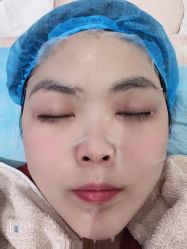 体验后-武汉颜范薇美医疗美容门诊部
