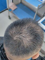 -雍禾植发全国连锁