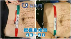 -蓝丝带产后恢复中心(都江堰店)