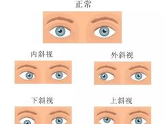 -中科优视医学研究院·验光配镜·近视防控