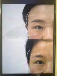-Yestar重庆艺星医疗美容医院