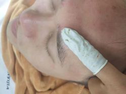 -荟草堂专业祛痘修护中心