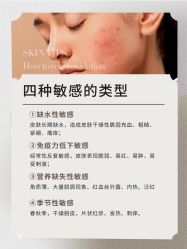 -POCO宝珂丽科技美肤