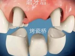 -团圆口腔·种植中心(锦江院区)