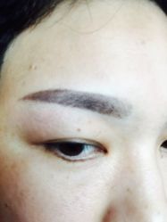 -郡艺医疗美容·微整·眼鼻吸脂
