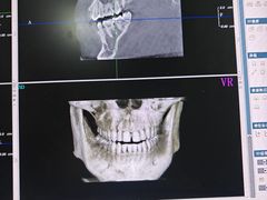 -土豆口腔(凤凰北总店)