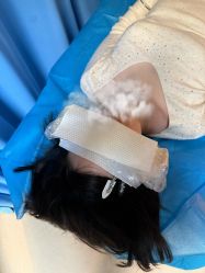 -广州健丽·去眼袋医疗美容机构