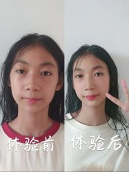 点击看大图 -Yestar重庆艺星医疗美容医院