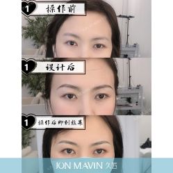 -久匠半永久纹眉