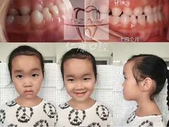 -Dr.Z dental仁康种植矫正中心