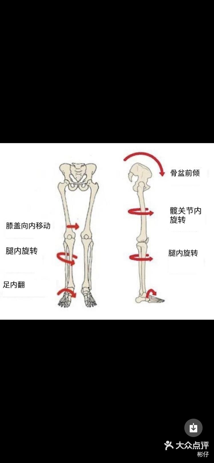 髋骨内旋纠正运动图片