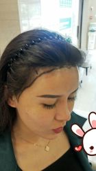 -大麦微针植发丨全国连锁