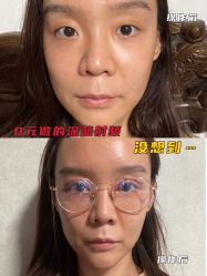-八大处整形
