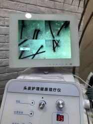 -IDOL-PLUS