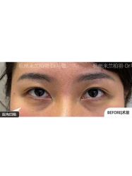 -杭州米兰柏羽医疗美容医院