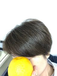 -钉格