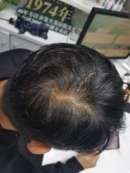 点击看大图 -章光101防脱养发荟
