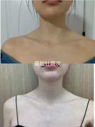 -上海漾颜医疗美容