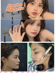 体验前-成都西区医院整形美容
